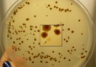 VAAM Mikrobe des Jahres 2019 VAAM Mikrobe des Jahres 2019